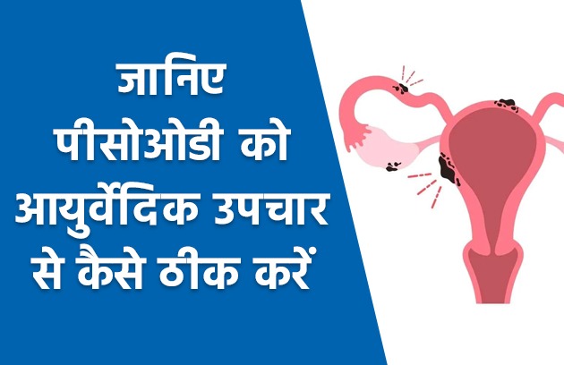 जानिए PCOD को आयुर्वेदिक उपचार से कैसे ठीक करें