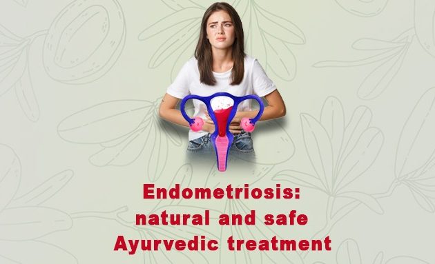 endometriosis treatment, Endometriosis Natural and safe ayurvedic treatment
