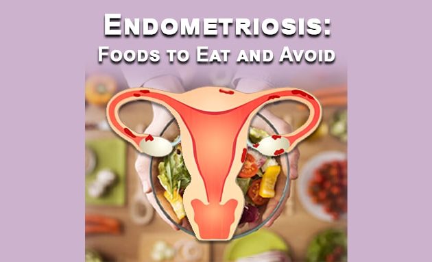 Endometriosis: foods to eat and avoid, herbs and Ayurvedic treatment