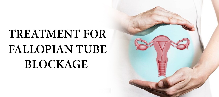 Natural Treatment for Tubal Blockage
