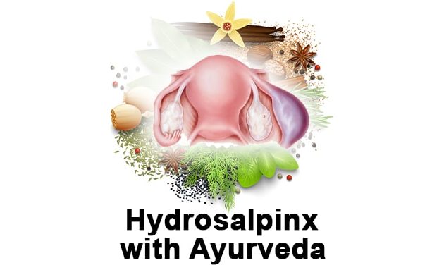 hydrosalpinx ayurvedic treatment, how to cure hydrosalpinx