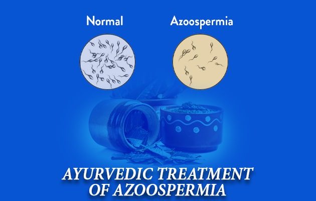Azoospermia Natural Treatment, Azoospermia symptoms and cuases