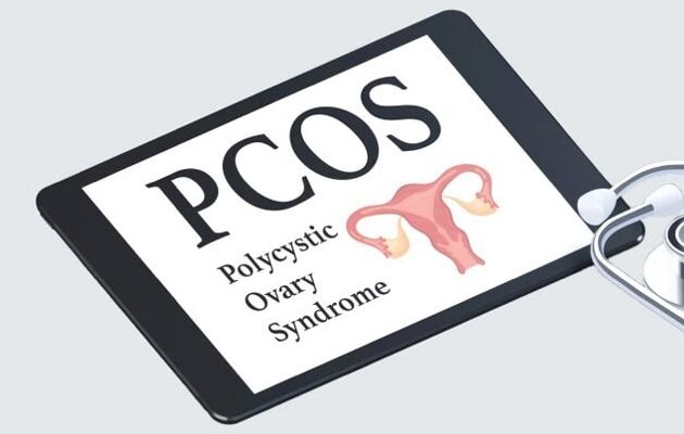 Ayurvedic treatment for Polycystic Ovary Syndrome