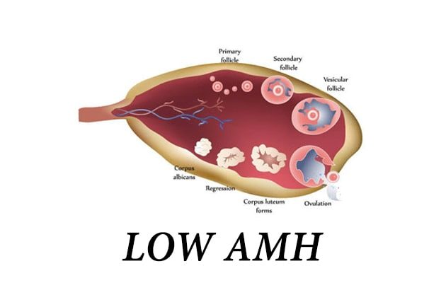 low amh, low amh ayurvedic treatment