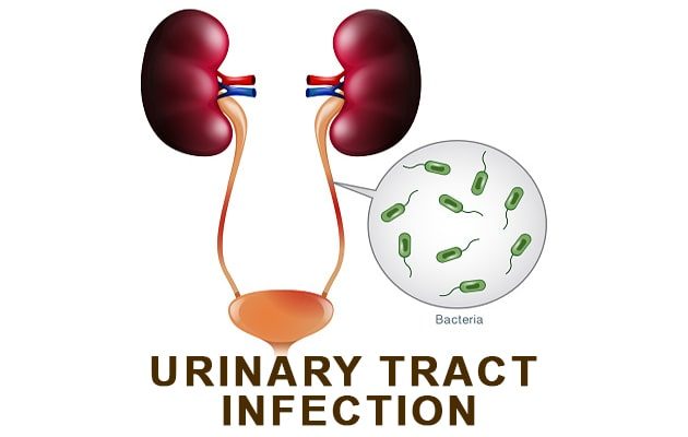 Ayurvedic treatment for urinary tract infection (UTI)