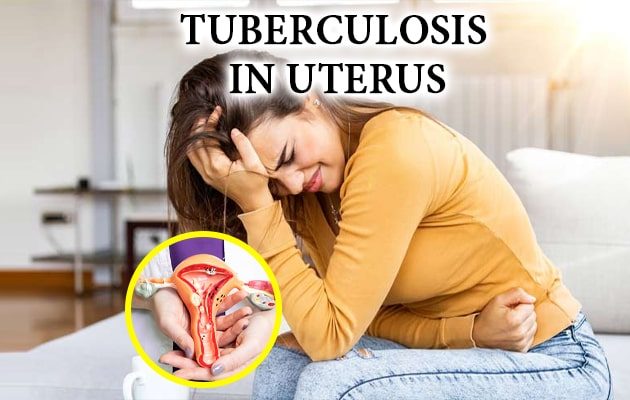 Tb in uterus Symptoms and Natural Treatment