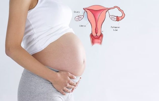Successful Pregnancy with one Fallopian Tube
