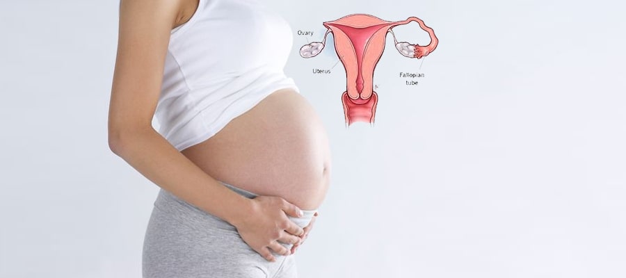 Successful Pregnancy with one Fallopian Tube