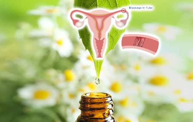 Natural Treatment for Fallopian Tubes Opening