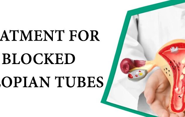Treatment for Blocked Fallopian Tubes - Dr Chanchal Sharma