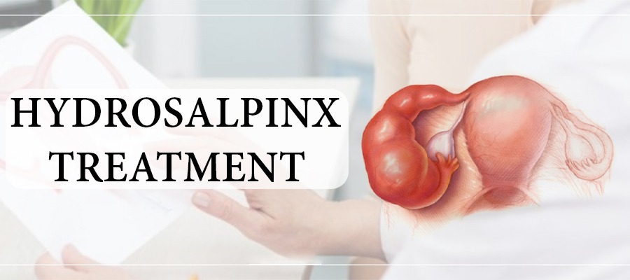 Treatment For Hydrosalpinx