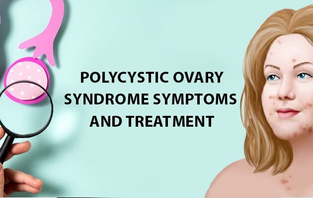 Polycystic Ovary Syndrome Treatment