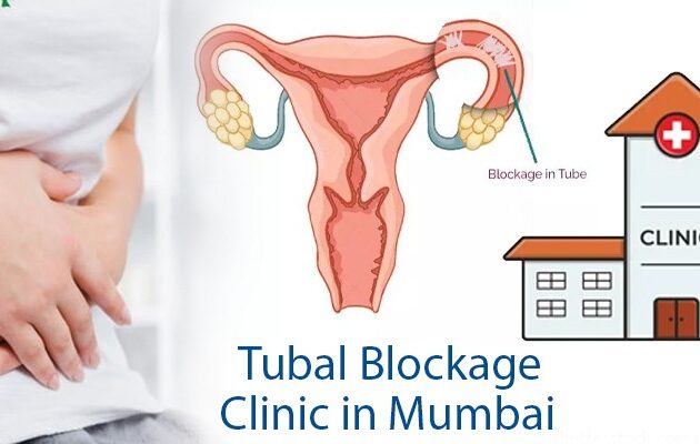 Tubal Blockage Clinic