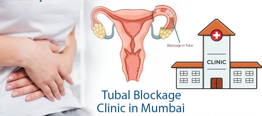 Tubal Blockage Clinic