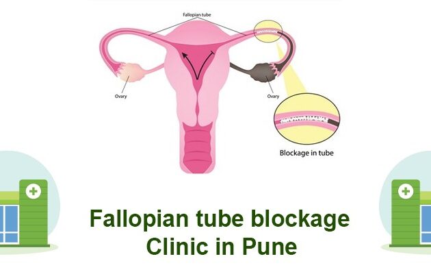 Fallopian Tube Blockage Clinic in Pune