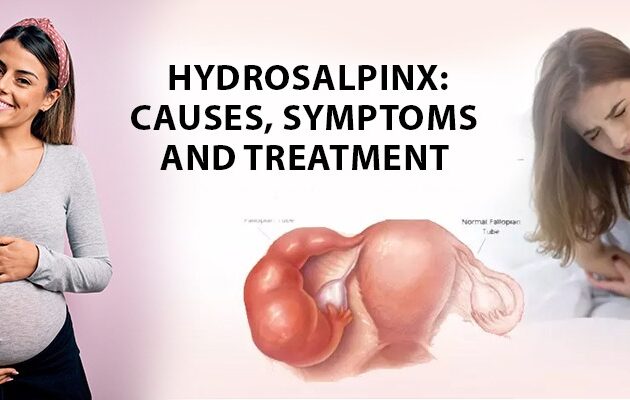 Treatment For Hydrosalpinx