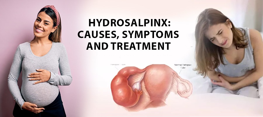Treatment For Hydrosalpinx