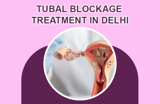 Tubal Blockage Treatment in Delhi