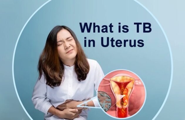 What is tb in uterus and symptoms of tb in uterus