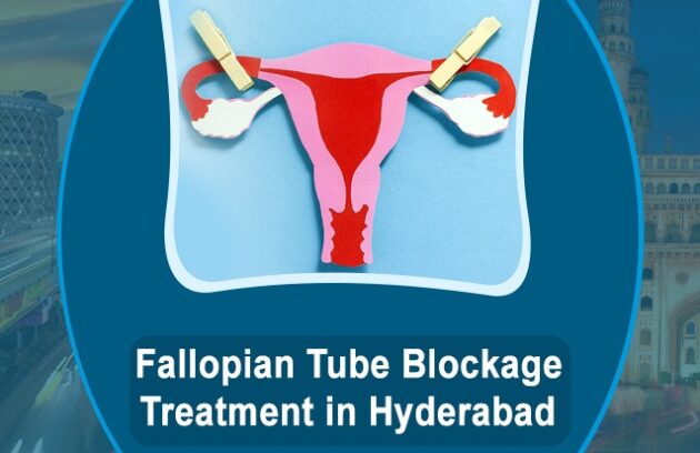 Fallopian Tube Blockage Treatment in Hyderabad