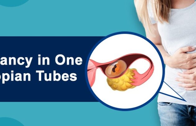 Pregnancy in One Fallopian Tubes