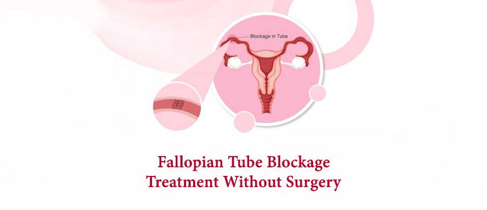 Treatment for Tubal Blockage with Ayurveda