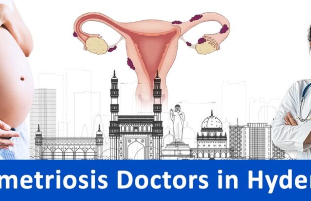 Find the Best Endometriosis Doctors in Hyderabad 2025