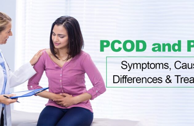 PCOS doctor in Delhi