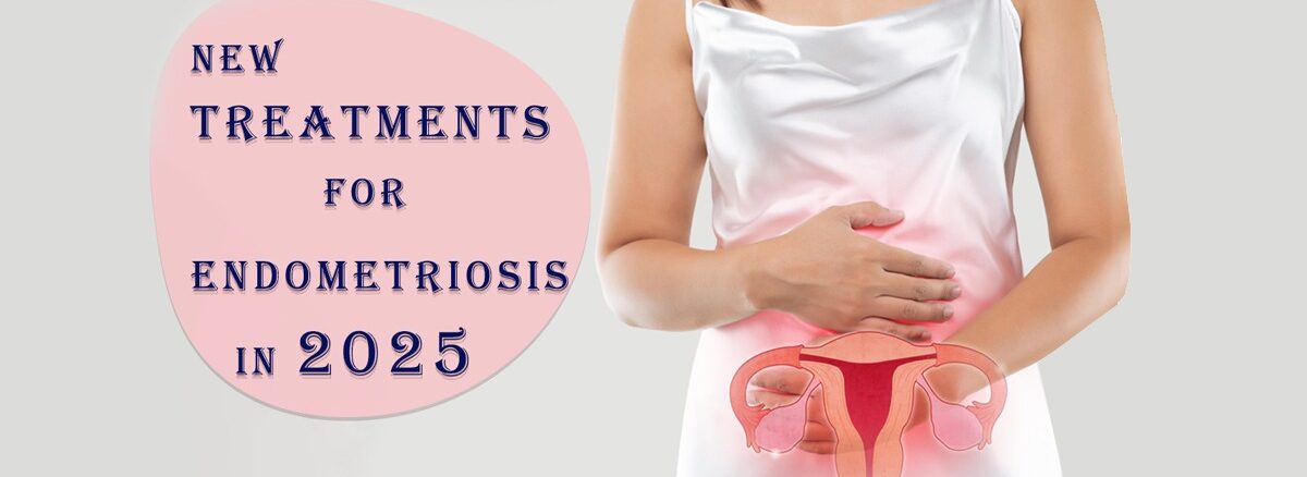 Endometriosis doctor in Delhi