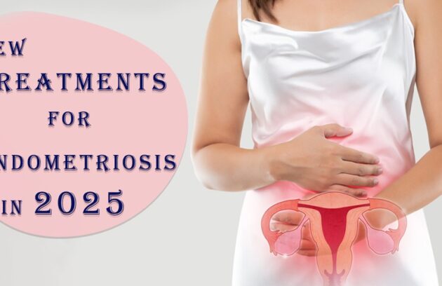 Endometriosis doctor in Delhi