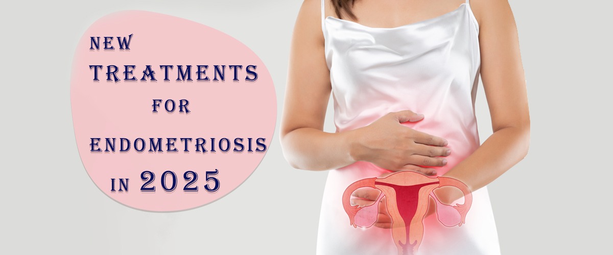 Endometriosis doctor in Delhi