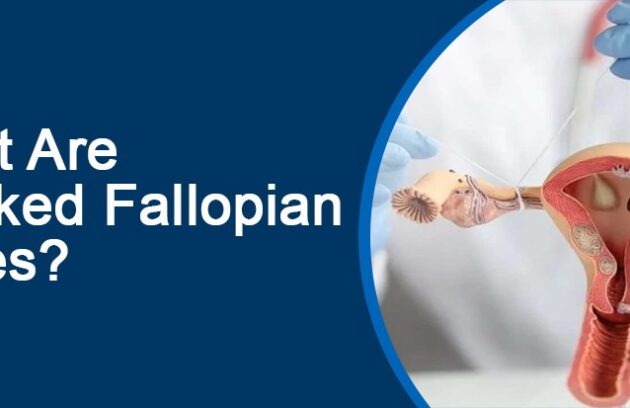 What Are Blocked Fallopian Tubes?