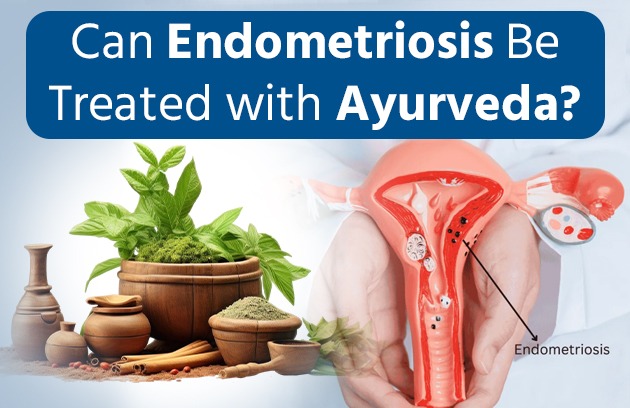Can Endometriosis Be Treated with Ayurveda?
