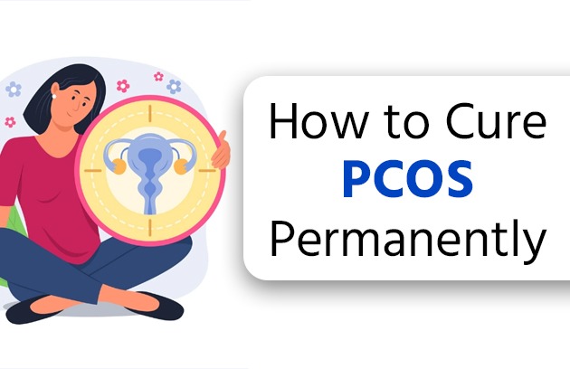How to Cure PCOS Permanently