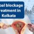 Tubal Blockage Treatment in Kolkata