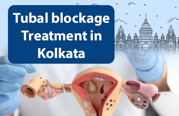Tubal Blockage Treatment in Kolkata