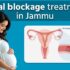 Tubal Blockage Treatment