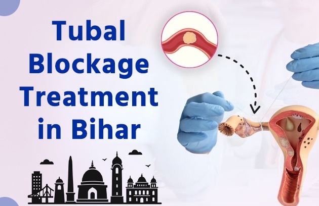 Tubal Blockage Treatment in Bihar