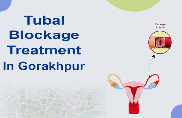 Tubal Blockage Treatment in Gorakhpur