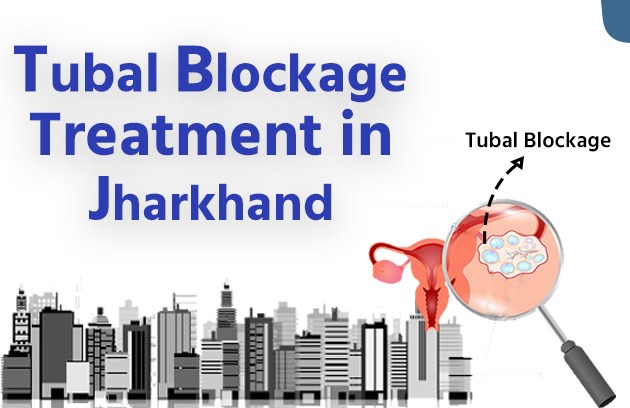 Tubal Blockage Treatment in Jharkhand