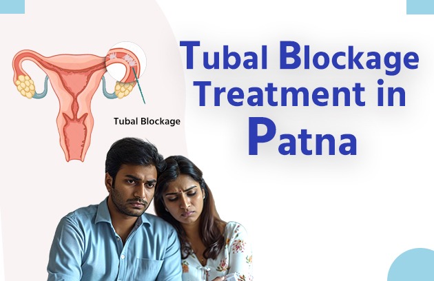 Tubal Blockage Treatment in Patna