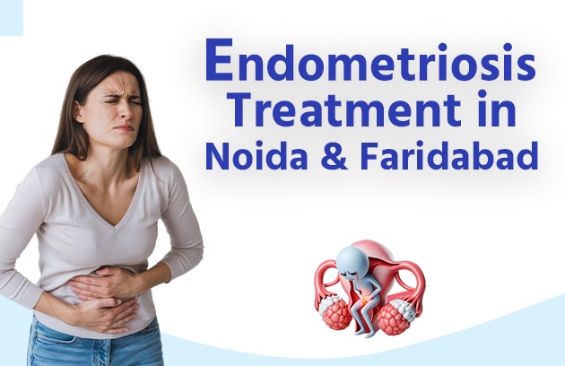 Endometriosis Treatment in Noida and Faridabad
