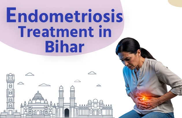 Endometriosis Treatment in Bihar 