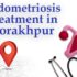 Endometriosis Treatment in Gorakhpur