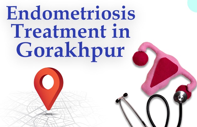 Endometriosis Treatment in Gorakhpur