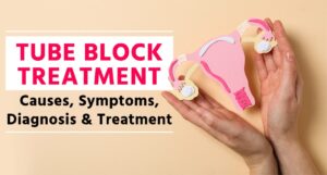 Tube block treament