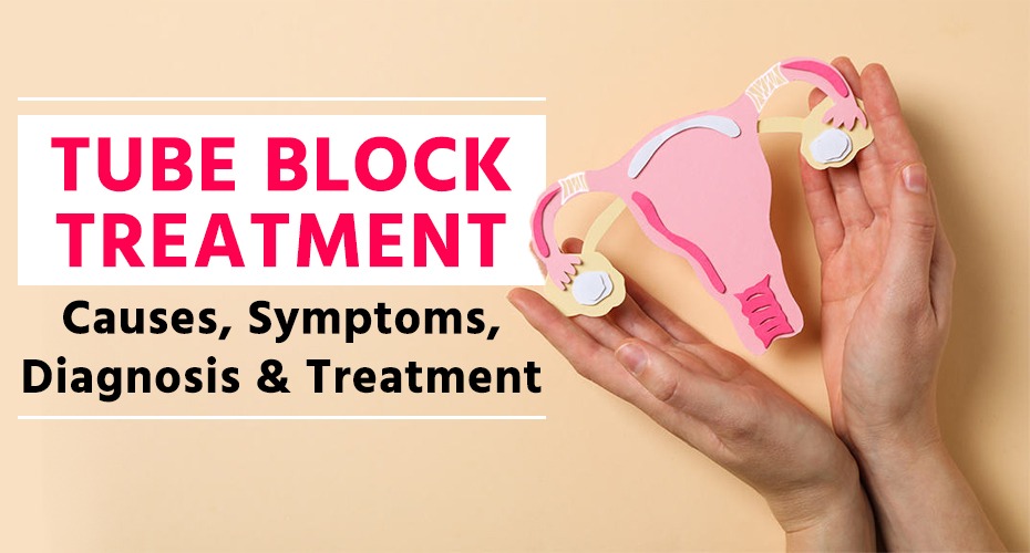 Tube Block Treatment: Causes, Diagnosis & Effective Treatment Options