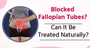Blocked Fallopian Tube Cure: Can a Blocked Tube Be Treated Naturally?