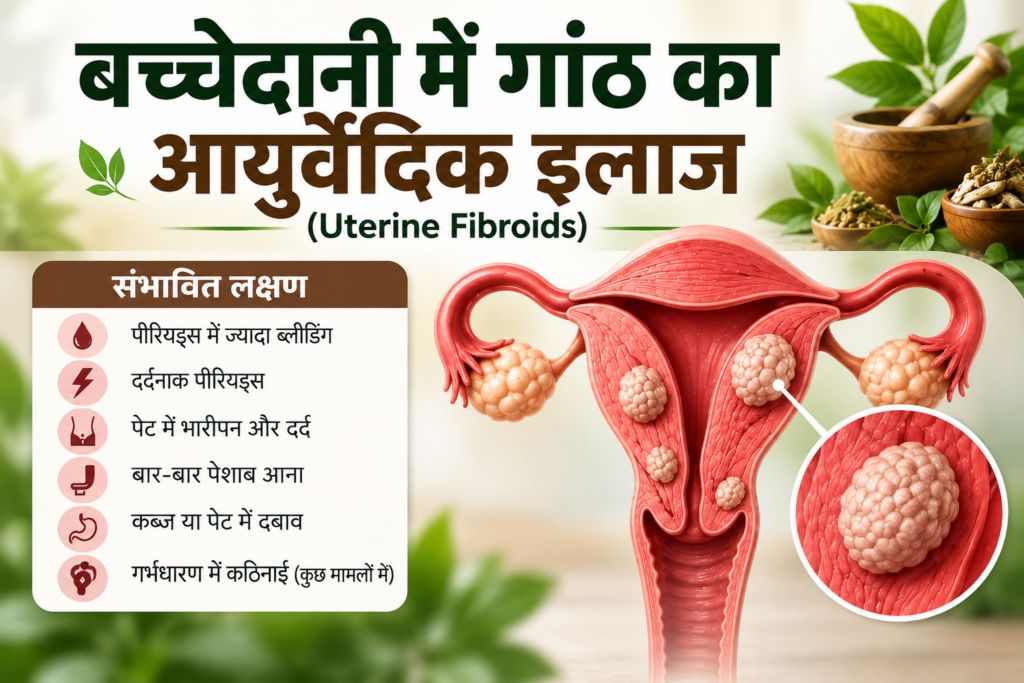 बच्चेदानी में गांठ का आयुर्वेदिक इलाज (Uterine Fibroids)